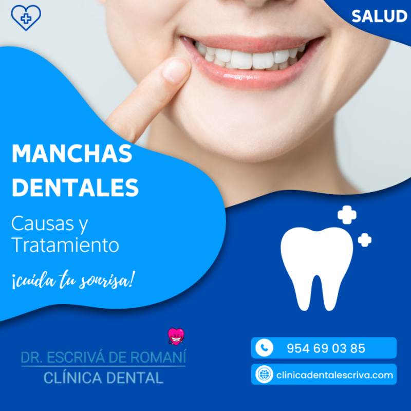 Manchas dentales. Qué son y cómo corregirlas